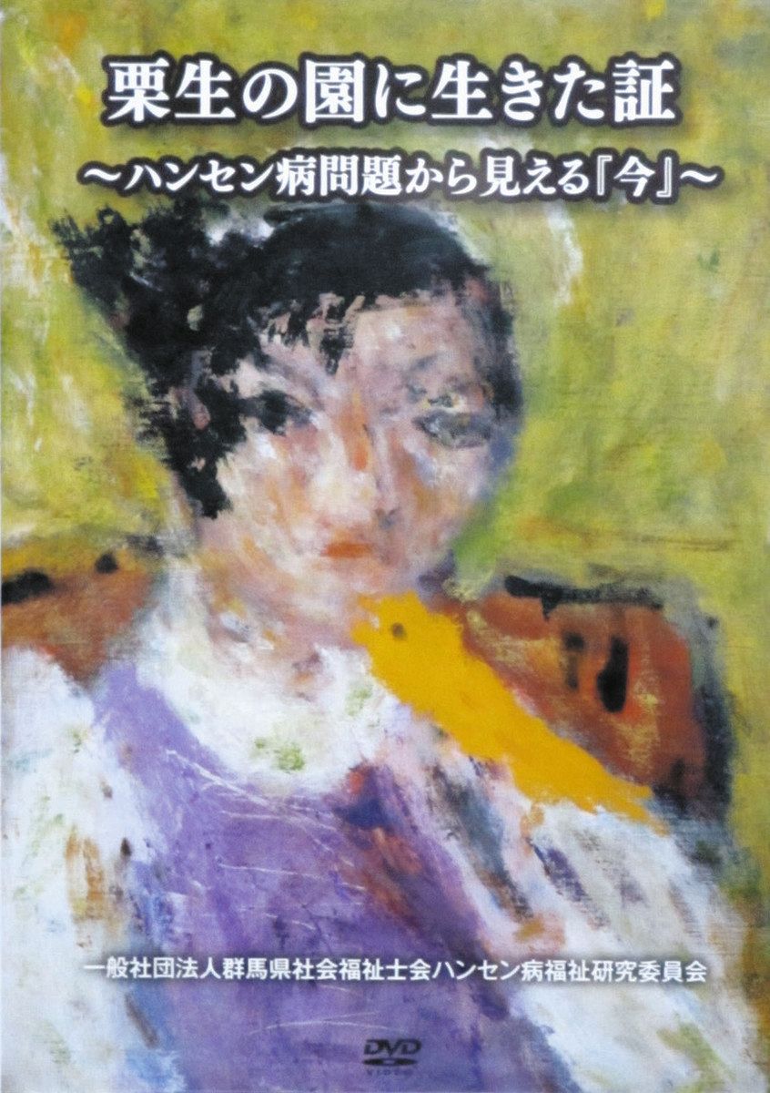 差別、社会への思い訴え 群馬のハンセン病療養所に入所・元患者ら証言