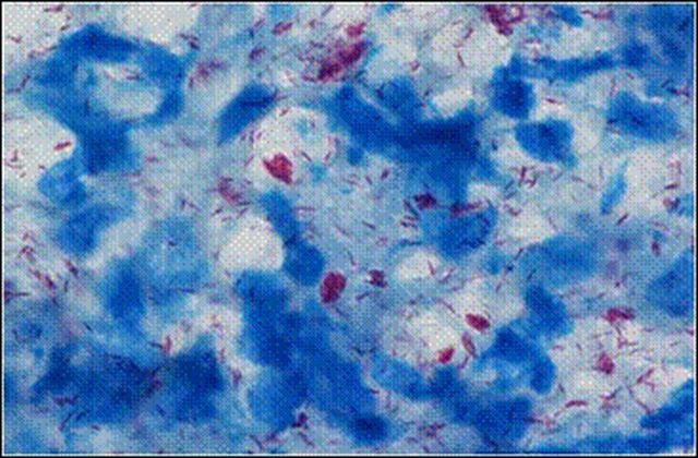 視点 感染力弱い で偏見はなくなるか コロナ禍にハンセン病問題を考える 文化芸能部 谷岡聖史 東京新聞 Tokyo Web