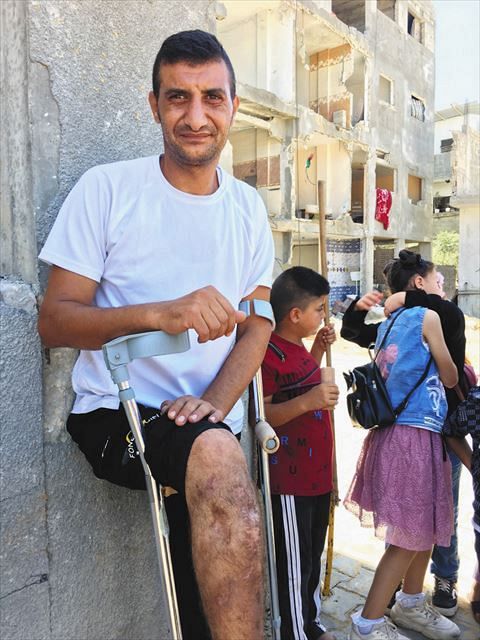 ７月末、パレスチナ自治区ガザで、５月のイスラエルの空爆で右足を骨折したフェイヤードさん。背後に壊れた住宅が見える
