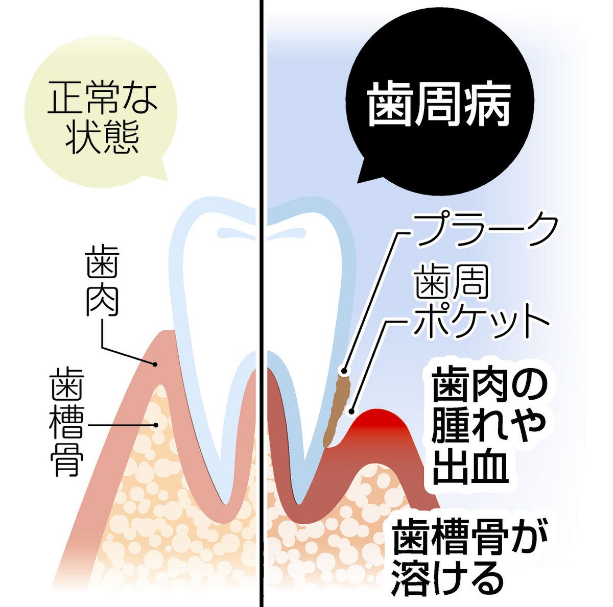くすりが活きる歯周病サイエンス 3198uXGT3CL.jpg