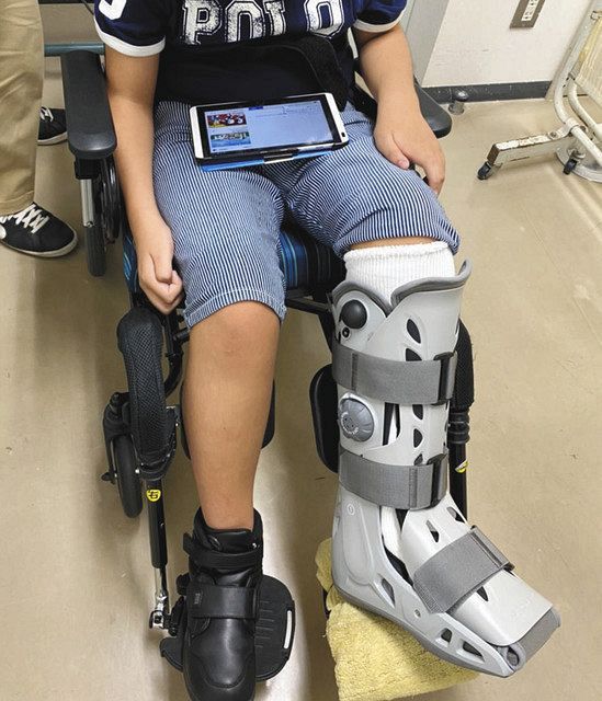 大けがした男子生徒。折れた左足の骨はまだくっつかず、装具を付けて生活している＝保護者提供