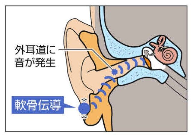 骨伝導の利点は何ですか？ _ 骨伝導 仕組み – FSNUGF