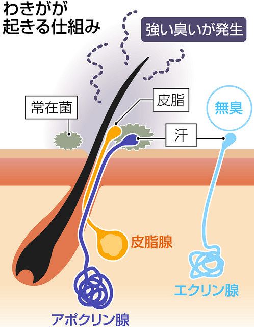 わきが治療、増える選択肢 塗り薬、注射、手術、電磁波照射 専門医「気になったら相談を」：東京新聞 TOKYO Web