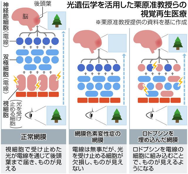 神経細胞をピンポイント操作「光遺伝学」 目の難病「網膜色素変性症