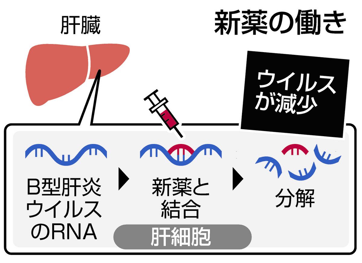 B型肝炎の新しい展開 [ペーパーバック] B型肝炎の新薬「ベピロビルセン」が秋にも実用化 継続的な服用がいら
