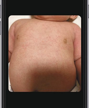 肌の状態など気になるところを写真で送ることもできる（いずれもＫｉｄｓ　Ｐｕｂｌｉｃ提供）