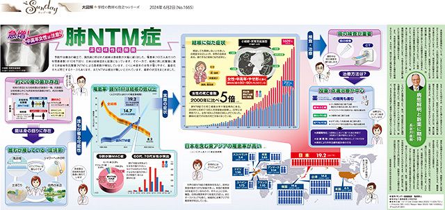 【裁断済】非結核性抗酸菌症 診療 Up to Date 非結核性抗酸菌症診療 Up to Date | 倉島篤⾏, ⼩川賢⼆, 森本