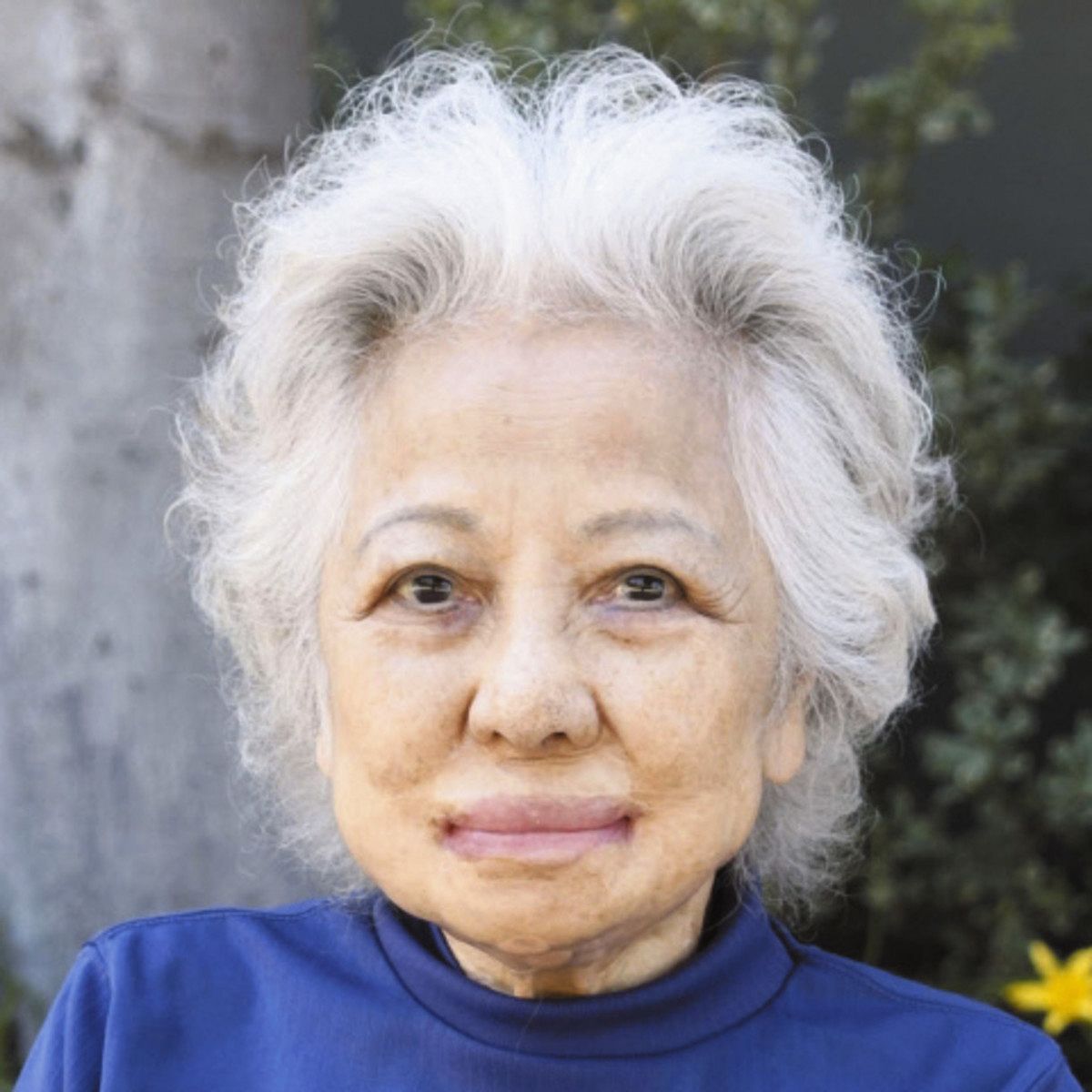 笹森恵子さん死去 渡米治療「原爆乙女」：東京新聞デジタル