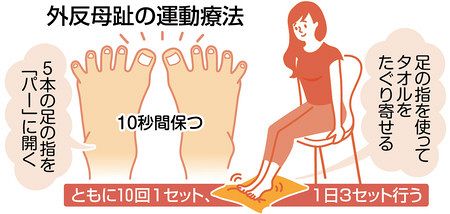 女性に多発 外反母趾 痛みが出る前に対処 東京新聞 Tokyo Web