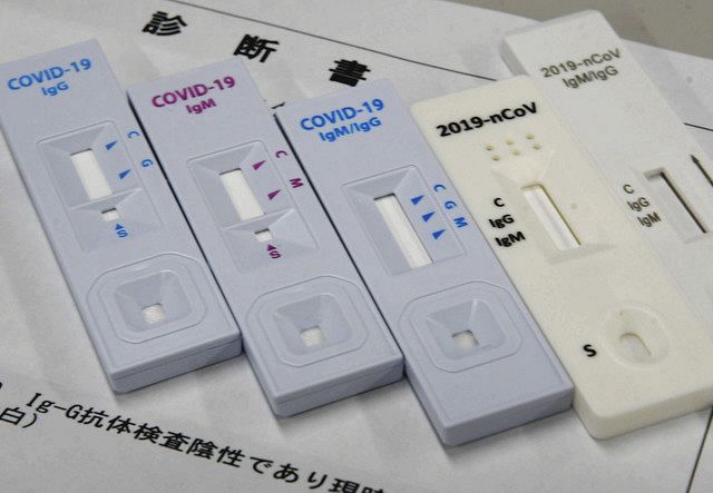 検査 コロナ 精度 簡易 キット 新型コロナウイルス PCR検査費用や検査キットについて、医師が解説｜オクノクリニック