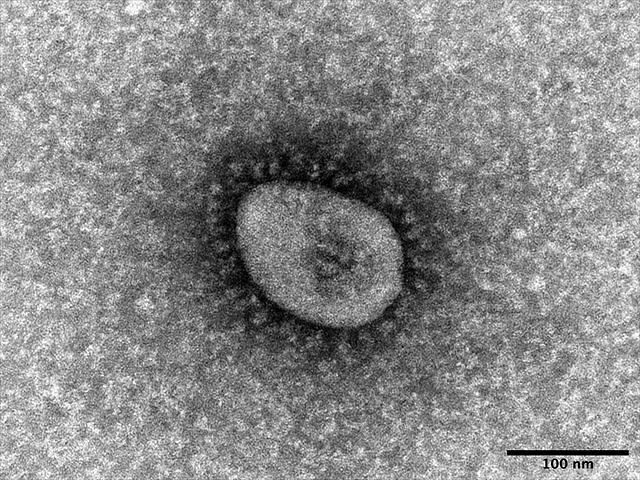 Omicron strain of novel coronavirus (National Institute of Infectious Diseases)