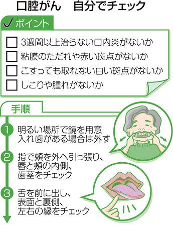 口腔がん 早期発見へ呼び掛け 定期的な歯科受診有効 東京新聞 Tokyo Web