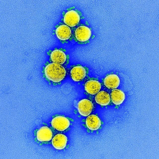 電気ショックのような頭痛 このまま死ぬのでは 対策していたのに コロナ感染の都議2人の体験 東京新聞 Tokyo Web 電気ショックのような頭痛 このまま死ぬのでは 対策していたのに コロナ感染の都議2人の体験 東京新聞 Tokyo Web