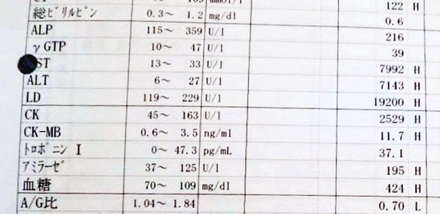 心肺停止で病院に搬送された際、病院が行ったウィシュマさんの血液検査の結果。異常な数値が並ぶ