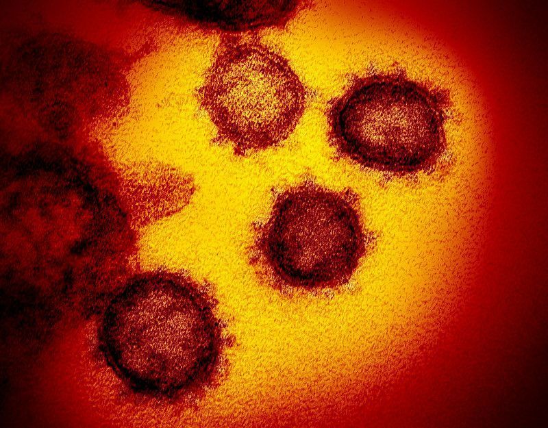 新型コロナウイルス（NIAID提供）
