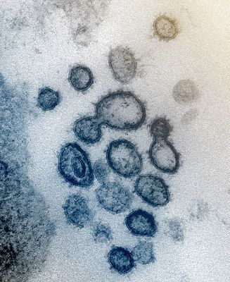 新型コロナウイルス（NIAID提供）