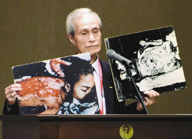２０１６年１２月、長崎市で開かれた国連軍縮会議で、原爆の熱線で負ったやけどの写真を見せる谷口稜曄さん
