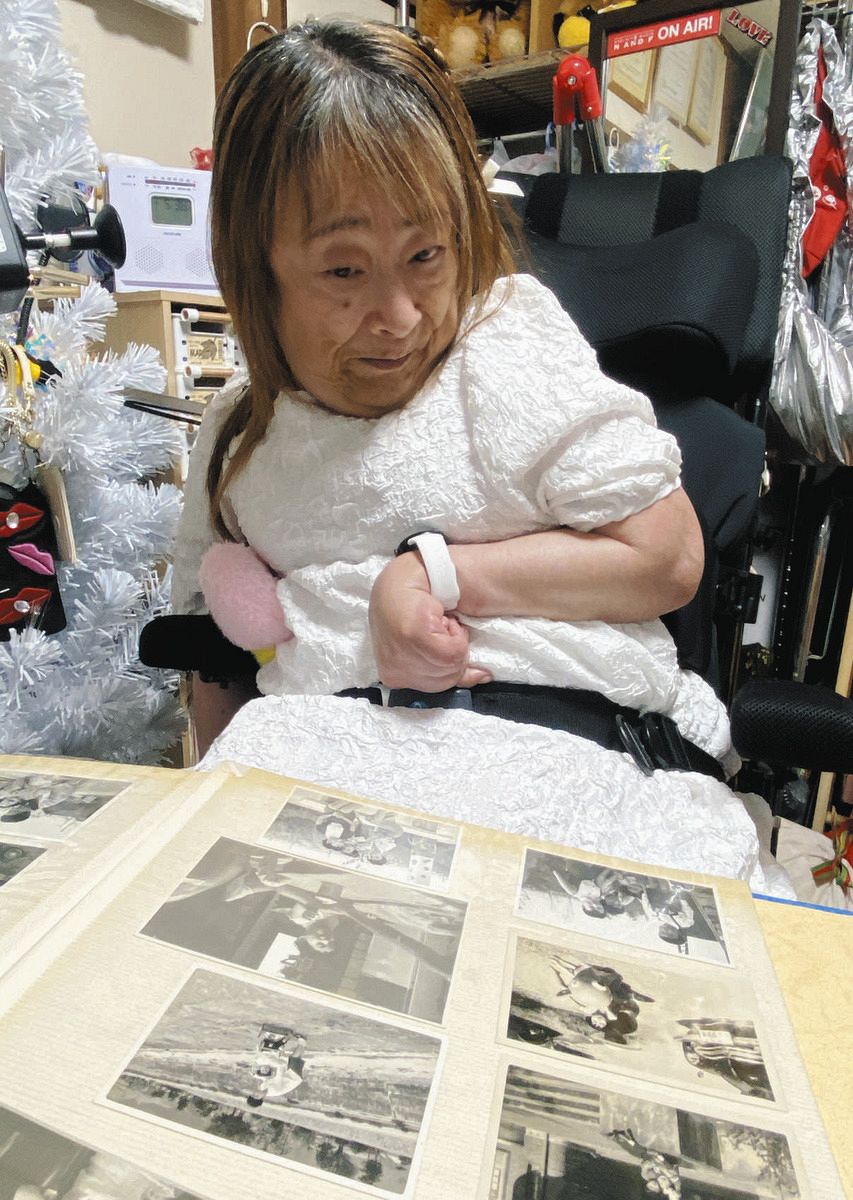 手術を受ける前の子ども時代の写真を見つめる鈴木由美さん＝神戸市で