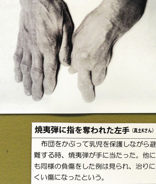 焼夷弾