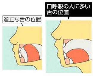 マスク下 口呼吸ご用心 唾液減り乾燥 雑菌繁殖の原因に 東京新聞 Tokyo Web