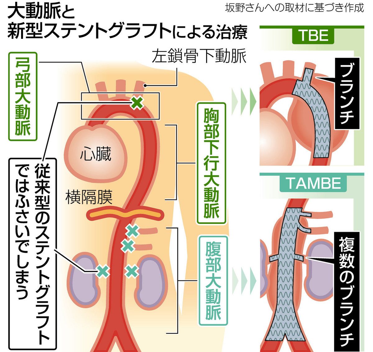 当時のメディア報道・掲載写真