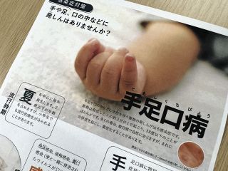 夏に子どもの間で流行「手足口病」が35都府県で警報レベルの広がり…専門家が説く「予防のポイント」は